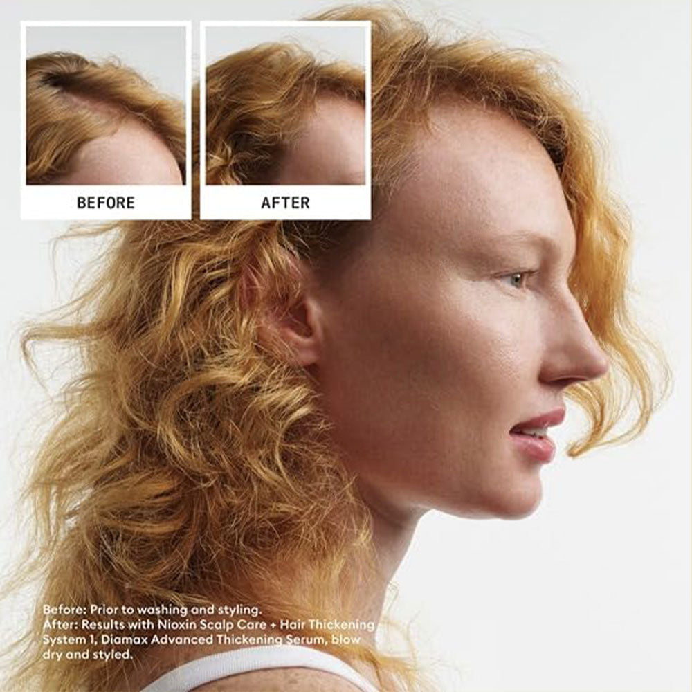 Nioxin System 1 Kit